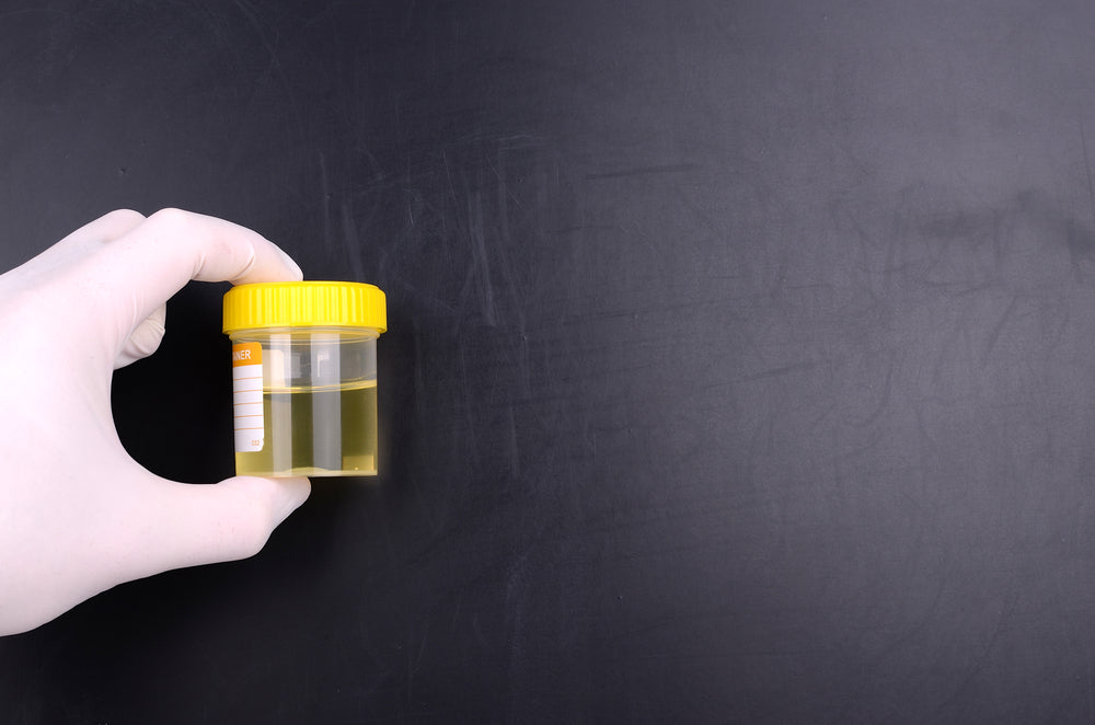ETG test urine alcohol test