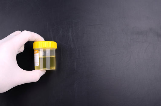 ETG test urine alcohol test
