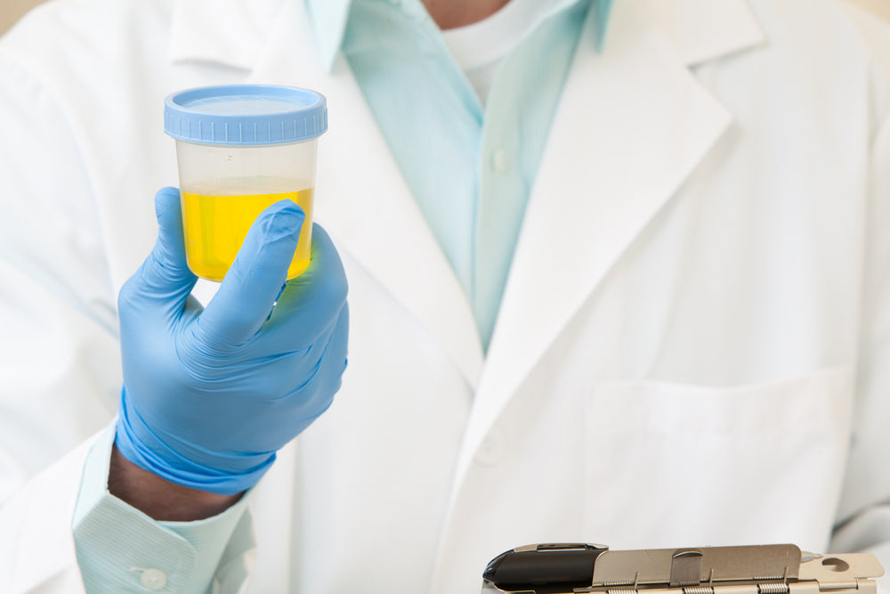 How Does A Urine Drug Testing Kit Work